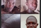 Residents Raise Alarm Over Outbreak Of Mpox Disease, As Benue Govt Active Investigation